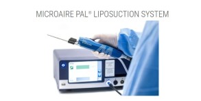The MicroAire PAL® Power-Assisted Liposuction System